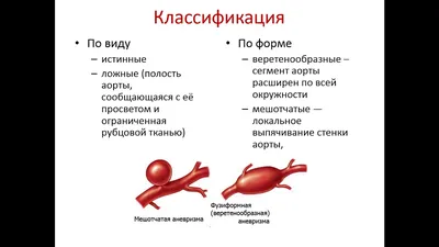 Пациентов с аневризмой сердца теперь будут оперировать в Ульяновске -  Новости Ульяновска \"Медиа73\"