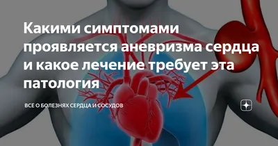 Аневризма аорты – что это, причины, классификация. Booking Health