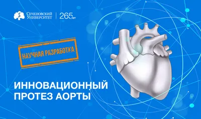 Аневризм сердца иллюстрация вектора. иллюстрации насчитывающей здоровье -  142481663