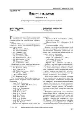 Васкулит: причины, виды, симптомы, диагностика и лечение васкулита