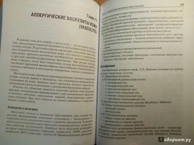 Системные васкулиты (Узелковый полиартериит, Чёрджа Стросса, Кавасаки,  Гудпасчера, Вегенера) - YouTube