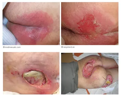 PDF) [The current classification of systemic vasculitides]