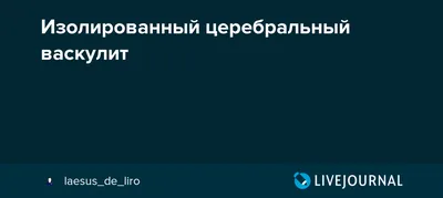 Васкулит: причины, диагностика и лечение. Классификация васкулитов.