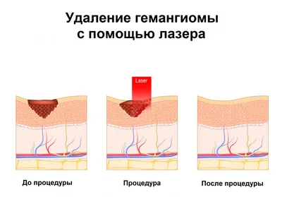 Почему полявляются красные точки на теле? — Семейная консультация