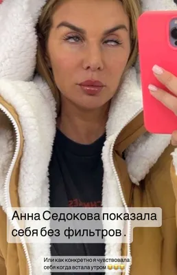 Косые глаза и морщины на шее: Анна Седокова показала себя без фильтров -  Звезды - WomanHit.ru