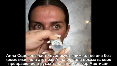 Анна Седокова сняла наращенные локоны и впервые показала свои настоящие  волосы - | Диалог.UA