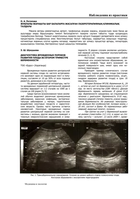 Пренатальная диагностика аномалии развития плода при беременности. Часть 2  - YouTube