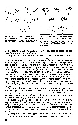 Глаза антимонголоидный разрез - Справочник по медицине PRO7