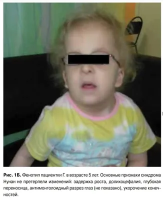 21 признак синдрома Нунан у ребёнка | Доктор Пискунов | Дзен