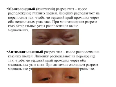 Занятие 1. Семиотика наследственных заболеваний Семиотика – учение о