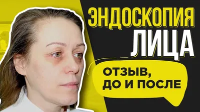 Сделать ментопластику - пластика подбородка, цены на уменьшение второго  подбородка | Москва