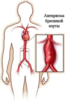 Анатомия: Ветви восходящей части аорты. Ветви дуги аорты. Плечеголовной  ствол