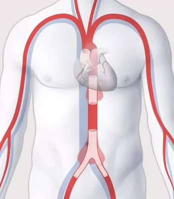 Бомба замедленного действия, или Что надо знать об аневризме аорты? —  Новости Шымкента