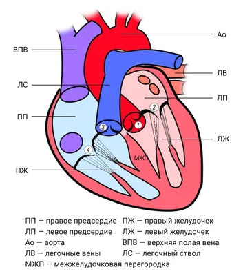 Что же такое порок сердца?