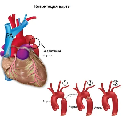 сердце и кровеносная система, картинка аорты, аорта, лекарственное средство  фон картинки и Фото для бесплатной загрузки