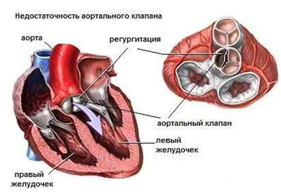 Аортальный клапан | это... Что такое Аортальный клапан?