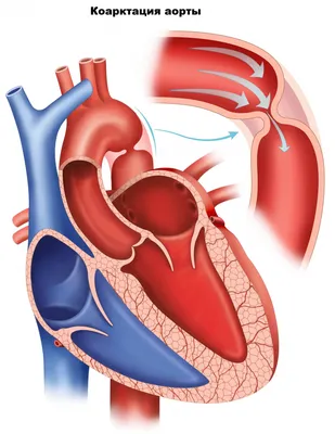 Телеканал Доктор - 🔺Факты об аорте🔺 🔺Аорта – самая крупная артерия  организма, берущая свое начало из левого желудочка сердца. 🔺Максимальный  диаметр аорты составляет 3 см. 🔺По аорте течет насыщенная кислородом  кровь, которая