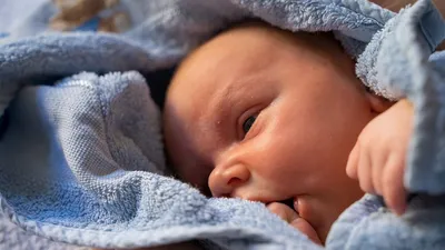 Шокирующие фото: страшный cиндром бабочки, в США родился младенец без кожи