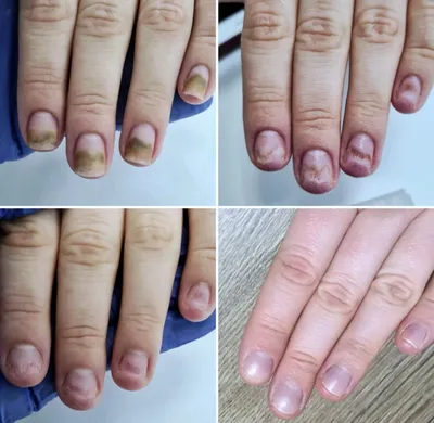 Курс аппаратный маникюр компании Nayada Nails