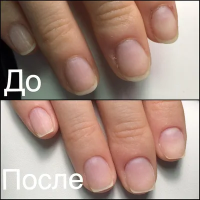 MADINA_NAILS on Instagram: “До/После. Снятие материала керамической фрезой  ДО базы. Комбинированный маникюр (аппарат+щипчики) Форма… | Маникюр, Ногти,  Дизайн ногтей