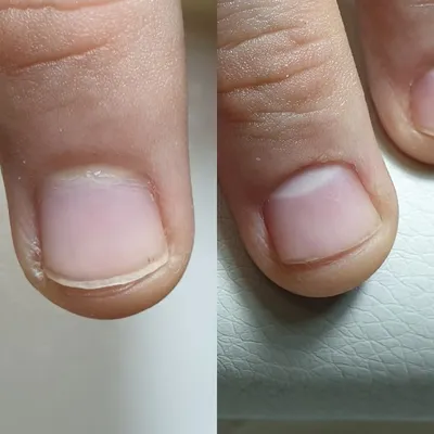 Гелевое укрепление на очень короткие ноготочки+аппаратный маникюр ❤💅 . До  и после🤗 Листаем➡️ Нежный нюд. . . . Запись по номеру… | Instagram