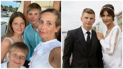 Появилось страшное видео с бывшей женой Аршавина, у которой пропал нос  из-за аутоиммунного некроза