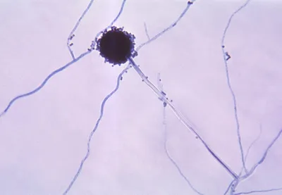 Порошок Хитозан Aspergillus Нигер покупать для виноделия Aspergillus Нигер  Хитозан - Китай Завод хитозан быть Веганом Низкая молекулярная масса,  Хитозан для дополнения рациона питания продуктов по уходу за кожей