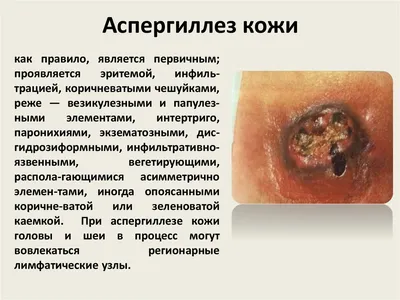 аспергиллус нигер на кожаном образце Стоковое Изображение - изображение  насчитывающей прессформа, грибково: 203043887