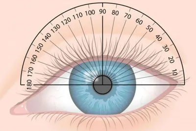 Астигматизм - Глазная клиника доктора Крячко