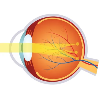 Астигматизм | Медицинский центр \"Диагност\" в Новосибирске