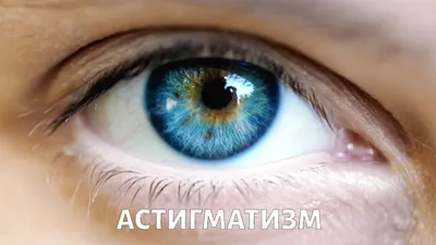 Что такое астигматизм? | Блог интернет-магазина Linza.com.ua