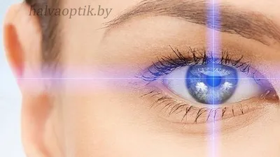 Астигматизм — патология, классификация, 2 вида лазерной коррекции зрения -  Офтальмологические клиники «Эксимер» (Одесса) - диагностика и лечение  заболеваний глаз у взрослых и детей