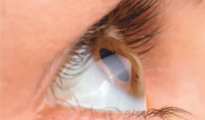 Эффективные упражнения для глаз: для чего нужны и как выполнять -  Офтальмологические клиники «Эксимер» (Киев) – диагностика и лечение  заболеваний глаз у взрослых и детей