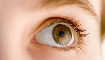 Замена хрусталика при астигматизме - Центр микрохирургии глаза доктора  Шаталова