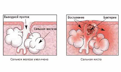 Новообразование на лице и волосистой части головы - вопросы и ответы