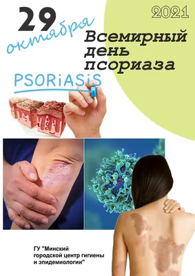 Лечение атопического дерматита - Центр европейской дерматологии