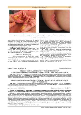Случай из практики: Распространенный псориаз вместо атопического дерматита  | Статьи врачей клиники EMC о заболеваниях, диагностике и лечении