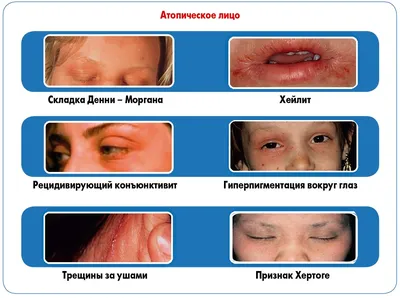 Сыворотка с гиалуроновой кислотой для кожи вокруг глаз Institut Esthederm  Intensive, 15 мл на сайте NAOS