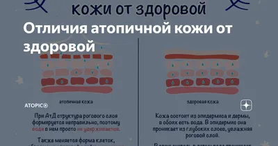 Набор уход за атопичной кожей по специальной цене - цена 363 руб., купить в  интернет аптеке в Москве Набор уход за атопичной кожей по специальной цене,  инструкция по применению