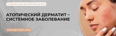 Объявление атопического дерматита, также известный как атопический экземы  тип Dermatitiseczema воспаления кожи и Pso атопического Стоковое  Изображение - изображение насчитывающей псориаз, лихорадка: 175589275