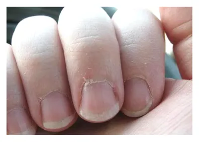 Диагностируем болезни по своим ногтям. Авитаминоз, анемия и проблемы с  печенью | Digital Beauty | Дзен