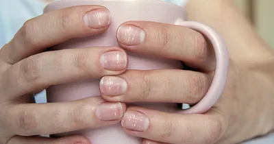 💅Короткие, обкусанные ногти – недостаток, который портит жизнь клиентам  независимо от возраста. Грызть ногти - это не только вредная и… | Instagram