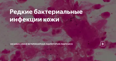 Вирусная и бактериальная инфекция. Как их распознать