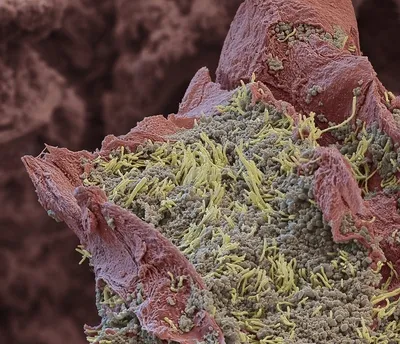 Бактерии во рту расскажут о человеке все