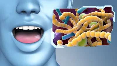 Иллюстрация Зуба С Бактериями Во Рту — стоковая векторная графика и другие  изображения на тему Зубы - Зубы, Инфекционная болезнь, Бактерия - iStock