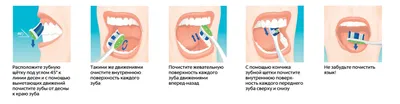 Язвы во рту - причины появления - Стоматология Москвы \"Королевская Улыбка\"