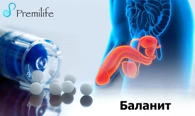 Баланит и Баланопостит ≡ лечение и препараты для лечения баланита - МИС  Аптека 9-1-1