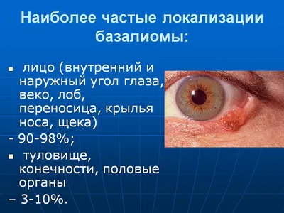 Ответ на пост «Теперь ненавижу врачей, не обращали внимание, а теперь рак»  | Пикабу