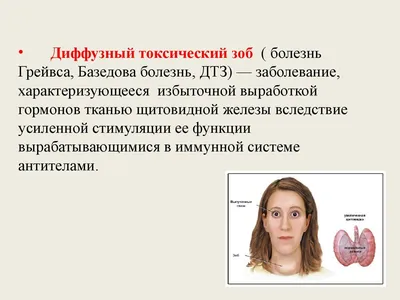 Тиреотоксикоз: диагностика и лечение в Минске недорого