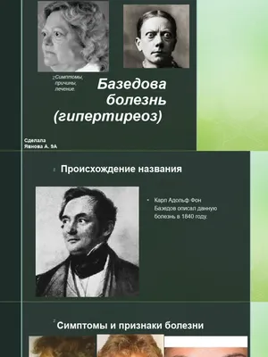 Гипертиреоз щитовидной железы симптомы и лечение в Екатеринбурге